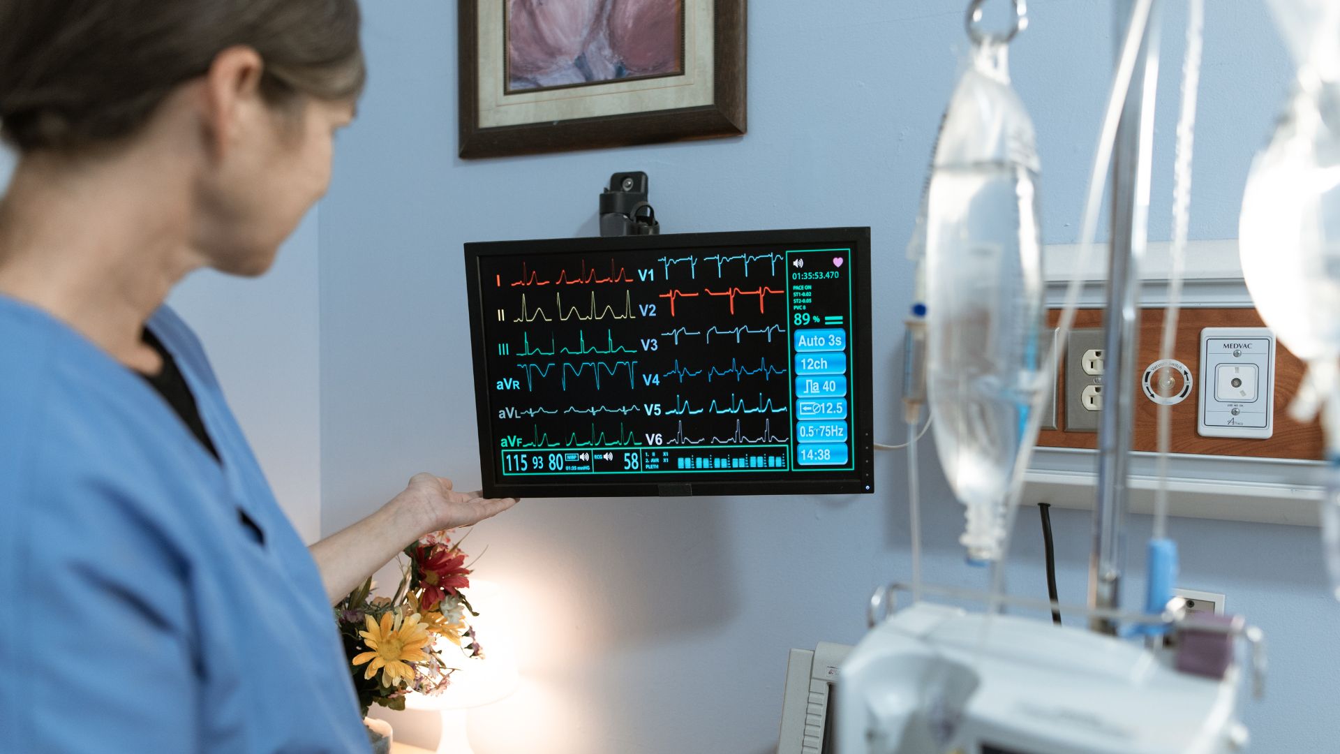 Eletrocardiograma